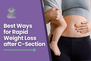 Best Ways for Rapid Weight Loss after C-Section